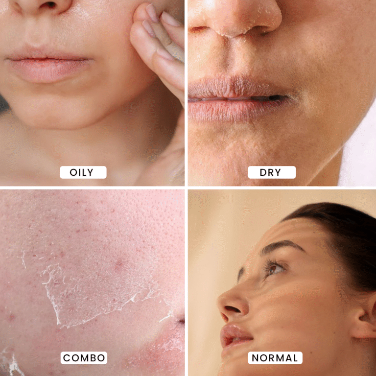 What Skin Type Are You? Find Out Here