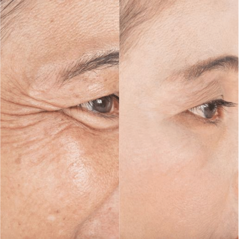 Best Anti-Ageing Cream for Wrinkles & Ageing